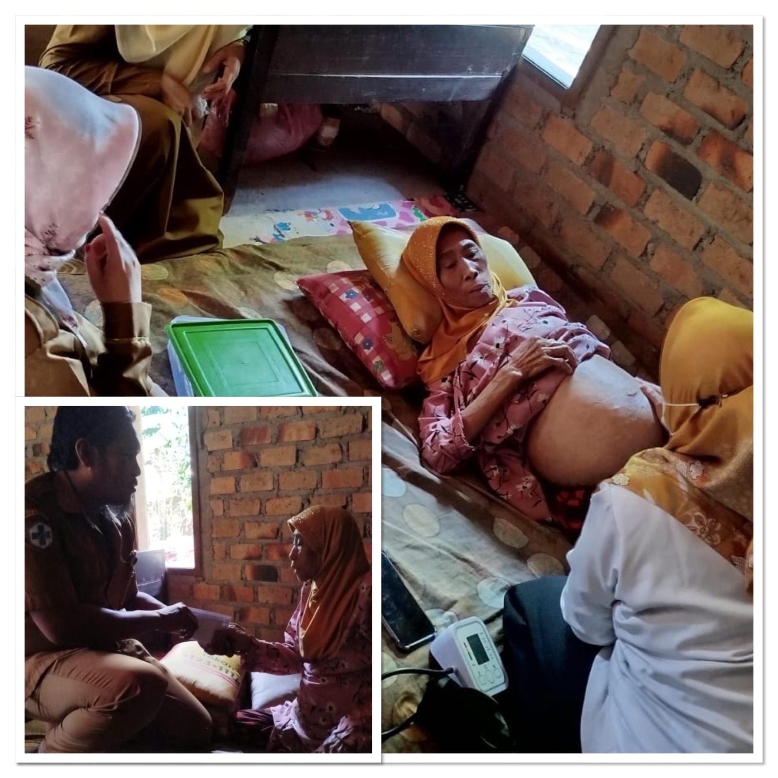 Puskesmas Bunga Mayang Jadi Harapan Pasien Kanker yang Kehabisan Biaya Berobat